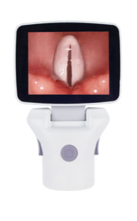 Postman Monitor-Kamera, für Videolaryngoskop