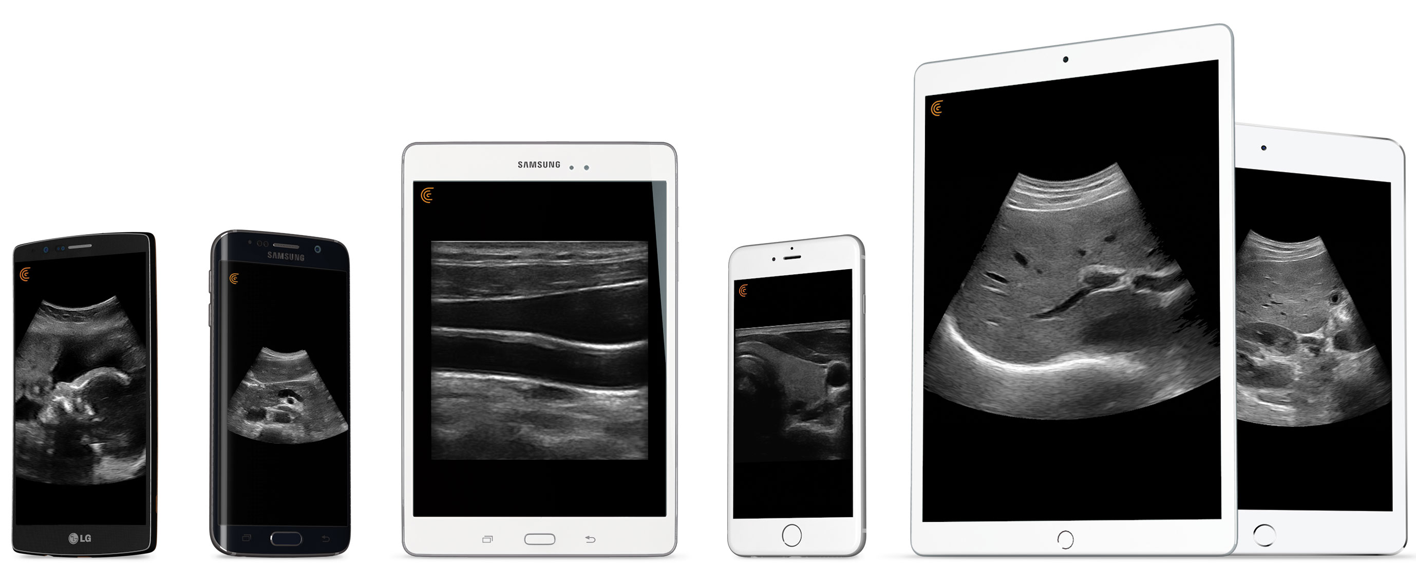 C3 HD3 Drahtloser Ultraschall-Scanner, mit 3-jähriger Clarius Mitgliedschaft