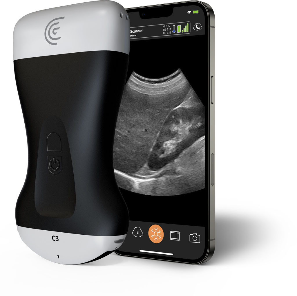 C3 HD3 Drahtloser Ultraschall-Scanner, mit 3-jähriger Clarius Mitgliedschaft