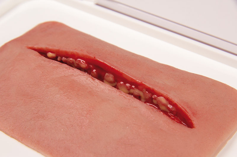 Wundmoulage Schnittwunde