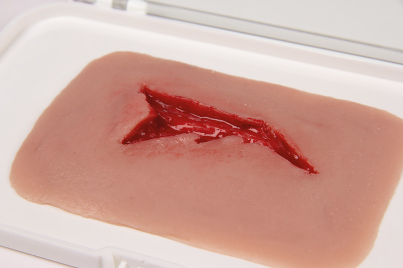 Wundmoulage Risswunde