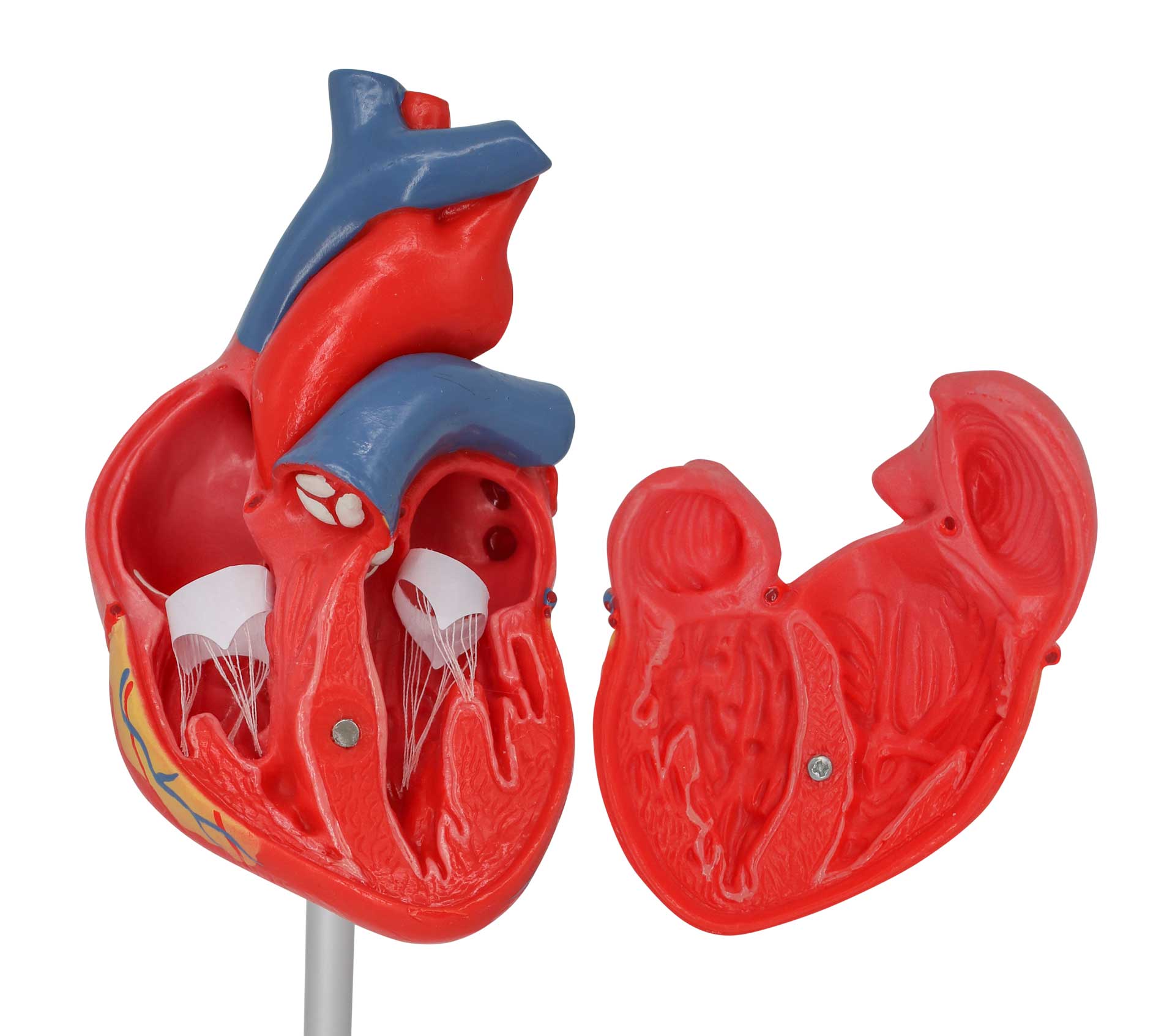 3D-EKG-Modell