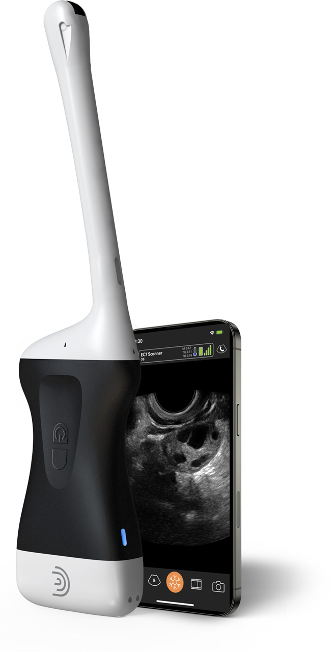 EC7 HD3 Drahtloser Ultraschall-Scanner
