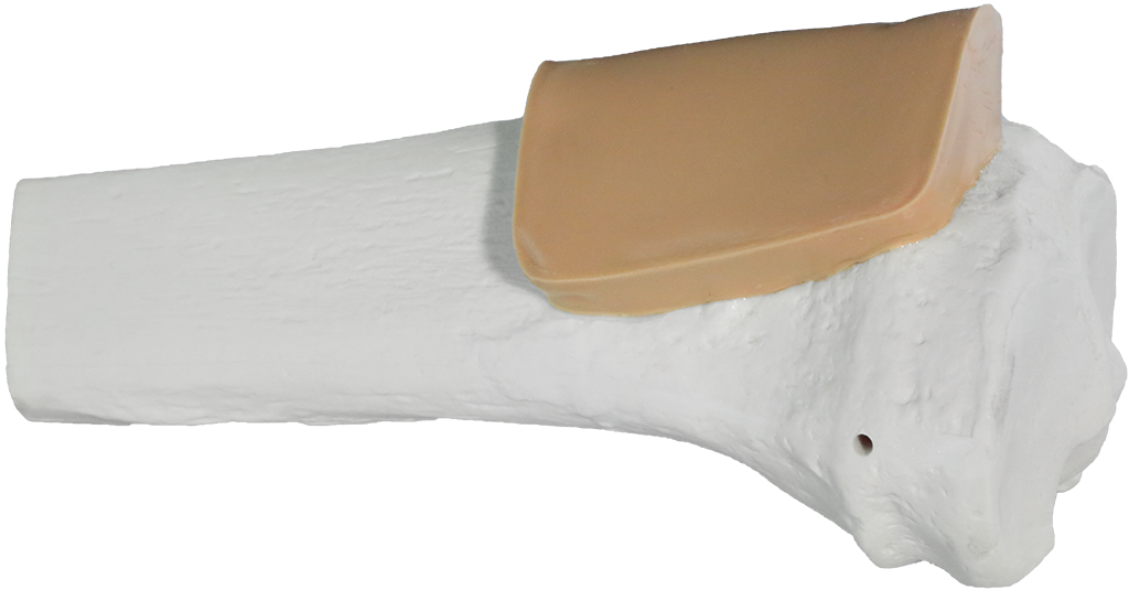 Tibia Übungsknochen Proximal, für Erwachsene