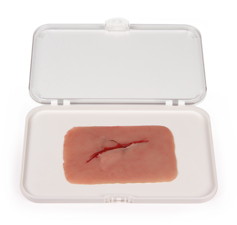 Wundmoulage Schnittwunde mit Glassplitter